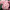 Гортензия древовидная Пинк Аннабель, Pink Annabelle
